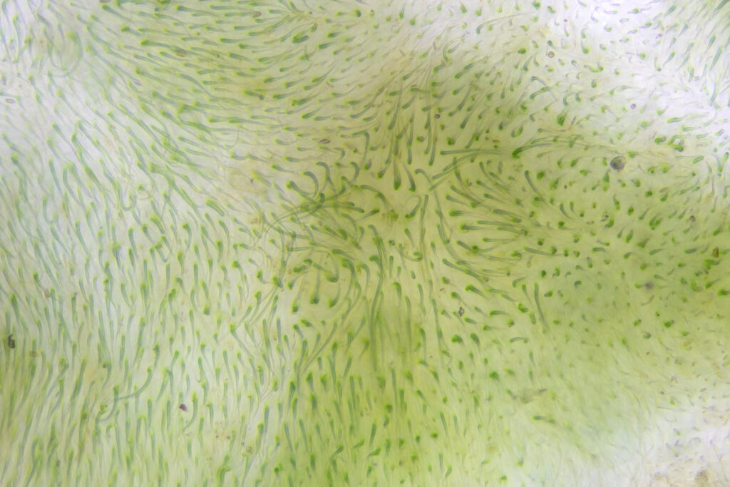 Microscopic view of Algae