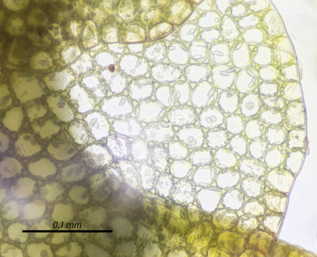 Liverwort Leaf Cells