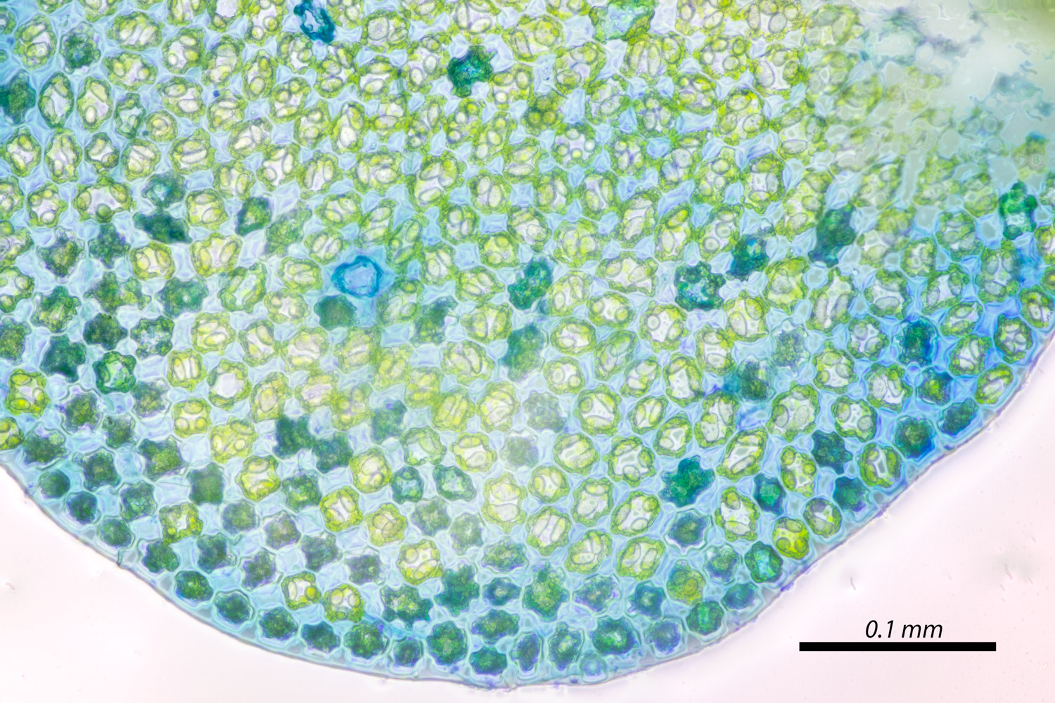 Odontoschisma denudatum stained with Methyl Blue