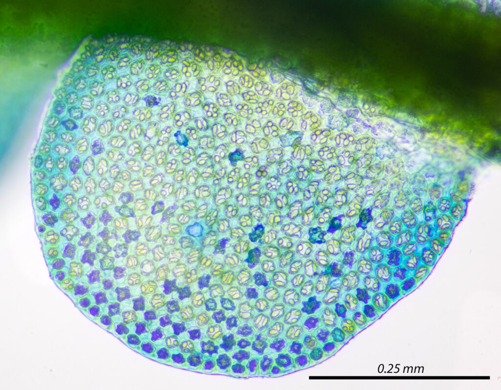 Odontoschisma denudatum stained with Methyl Blue